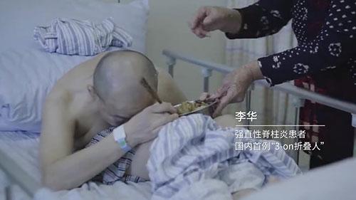 身體被敲斷4次的折疊人出院,打開折疊人生(圖2) 身體被敲斷4次的折疊人出院,打開折疊人生(圖2)