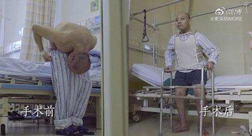 身體被敲斷4次的折疊人出院,打開折疊人生(圖15) 身體被敲斷4次的折疊人出院,打開折疊人生(圖15)
